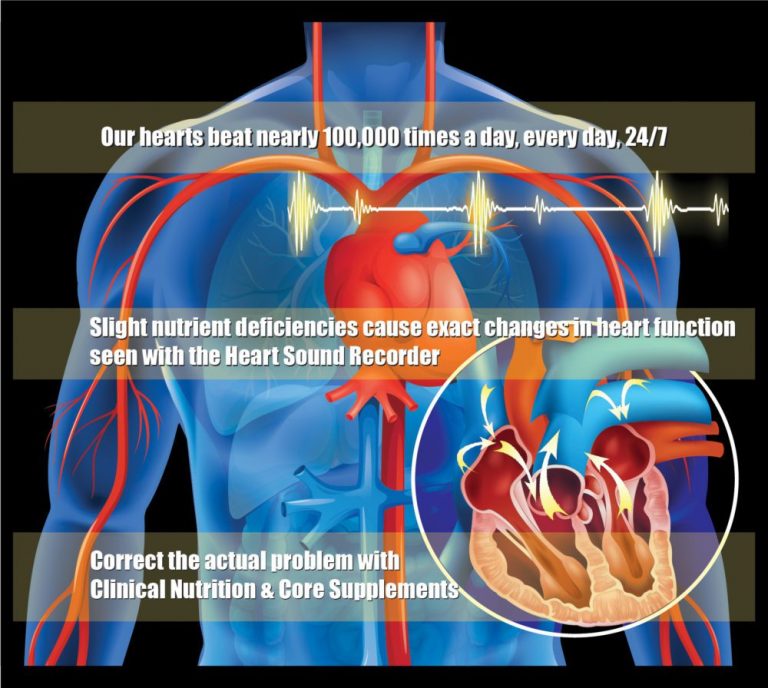 Heart Sound Recorder - Frye Functional Health Center